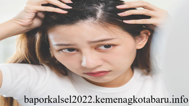 5 Tips untuk Mengurangi Rasa Gatal Karna Ketombe